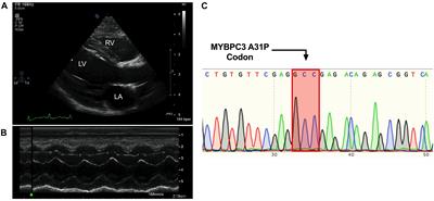A Novel Homozygous Intronic Variant in TNNT2 Associates With Feline Cardiomyopathy